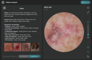 idea® Wissensdatenbank zur Dermatoskopie